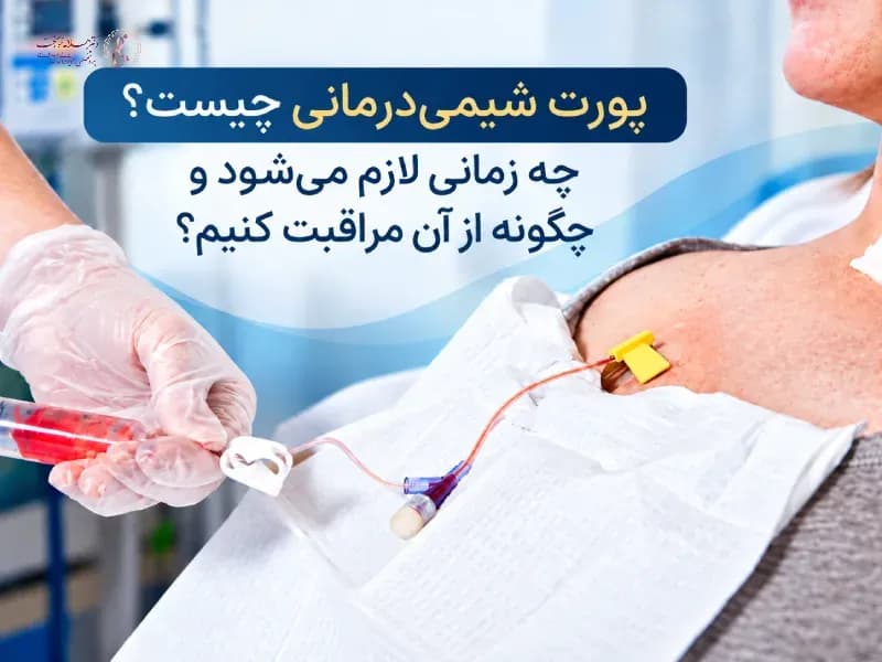 پورت شیمی‌درمانی چیست