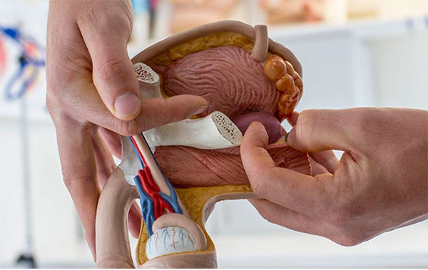 سرطان پروستات پیشرفته